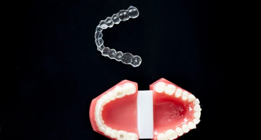 Benefits of Aligners Treatment