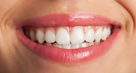 After Orthodontic Treatment