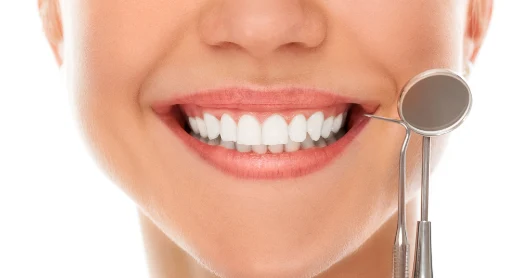 After Smile Designing Treatment